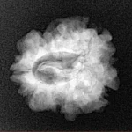 1 Mukhi Rudraksha 22.8mm 3.06gm - Xray