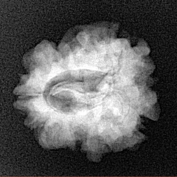 1 Mukhi Rudraksha 22.8mm 3.06gm - Xray