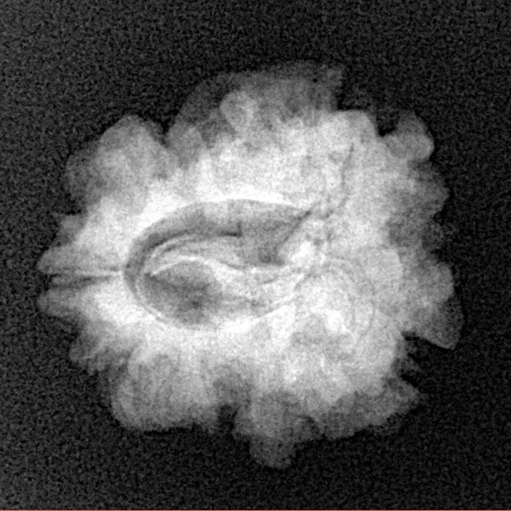 1 Mukhi Rudraksha 22.8mm 3.06gm - Xray
