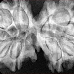 11 MK Gaurishankar 40.3mm 8.66gm - Xray