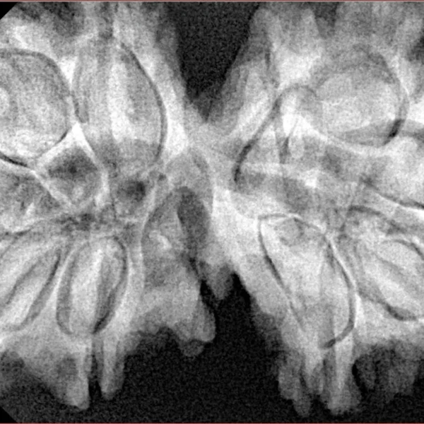 11 MK Gaurishankar 40.3mm 8.66gm - Xray