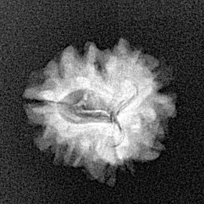 1 Mukhi Rudraksha 21.1mm 2.6gm - Xray