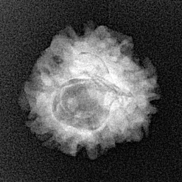 1 Mukhi Rudraksha 18.9mm 2.09gm - Xray