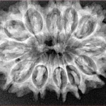 12 Mukhi Rudraksha 32.4mm 5gm - Xray