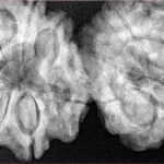 12 MK Gaurishankar 43.8mm 11gm - Xray
