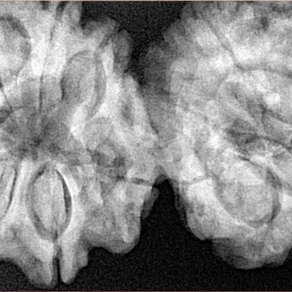 12 MK Gaurishankar 43.8mm 11gm - Xray