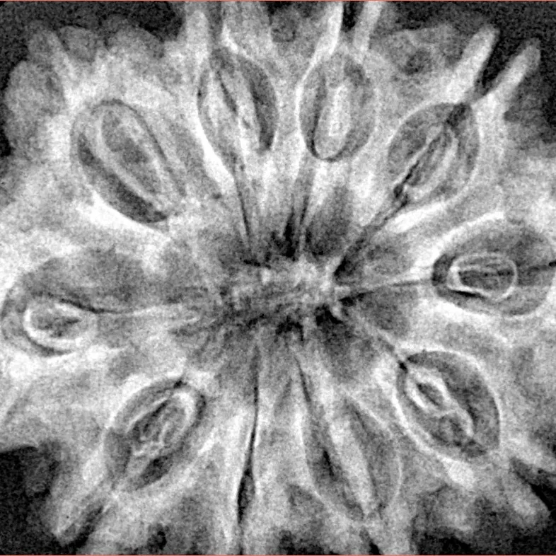 10 Mukhi Rudraksha 32.7mm 7gm - Xray