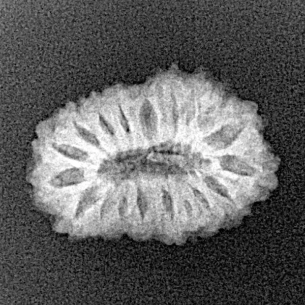 17 Mukhi Rudraksha 19.3mm 1.67gm - Xray