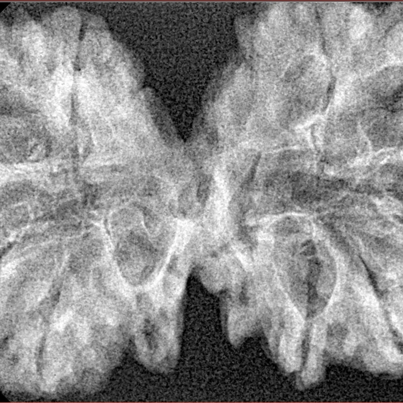 9 MK Gaurishankar 41.4mm 5.61gm - Xray