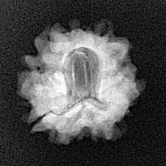 1 Mukhi Rudraksha 19.4mm 2gm - Origin: North India - Xray