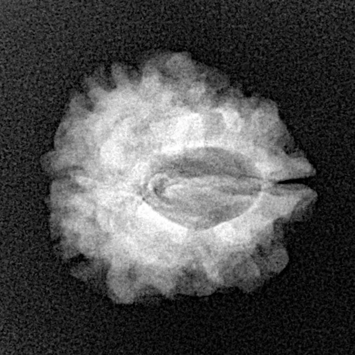 1 Mukhi Rudraksha 20.9mm 2.42gm - Xray