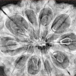 10 Mukhi Rudraksha 34.1mm 6.4gm - Xray
