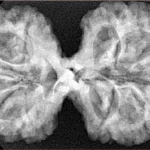 10 Mk Gaurishankar 38.8mm 7.67gm - Xray