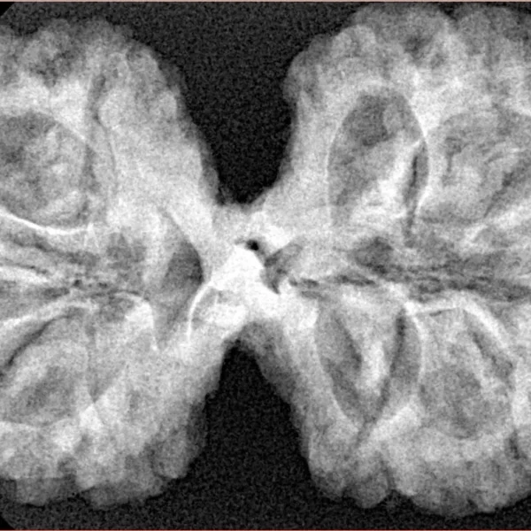 10 Mk Gaurishankar 38.8mm 7.67gm - Xray