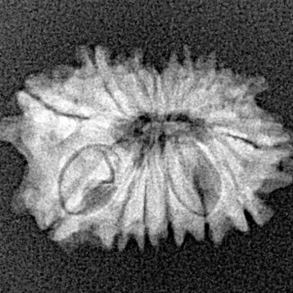 14 Mukhi Rudraksha 20.1mm 1.53gm - Xray