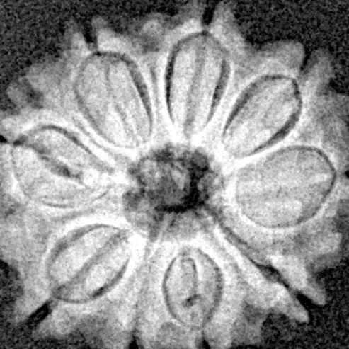 9 Mukhi Rudraksha 18.9mm 2gm - Xray