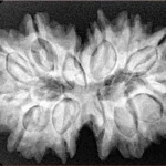13 MK Gaurishankar 32.3mm 6.6gm - Xray
