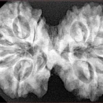 11 MK Gaurishankar 37.8mm 7.79gm - Xray