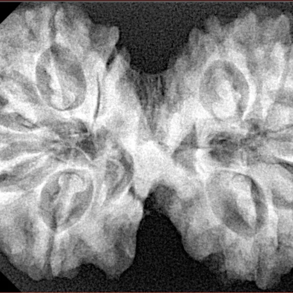 11 MK Gaurishankar 37.8mm 7.79gm - Xray