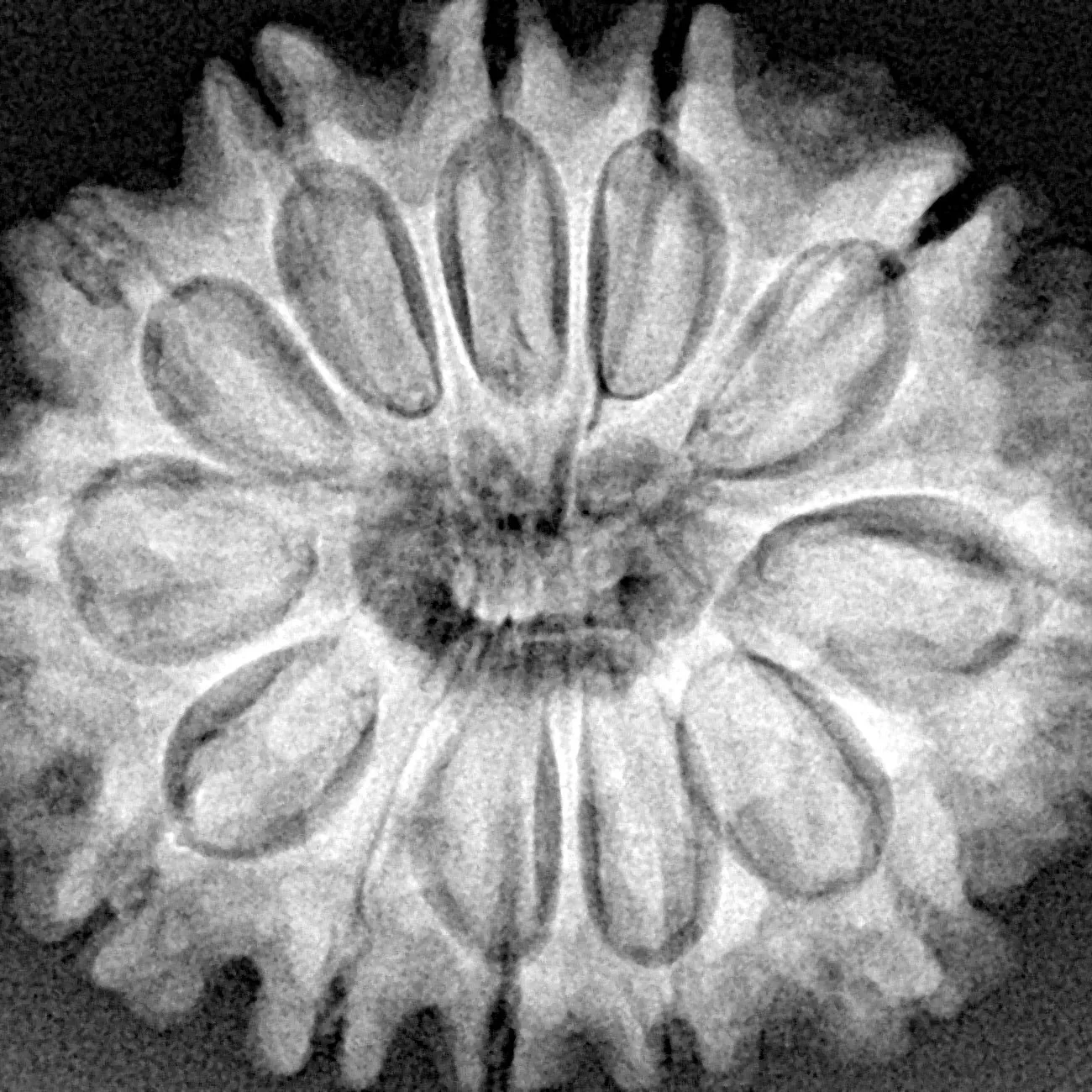 12 Mukhi Rudraksha 30mm 6.68gm - Xray