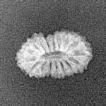 17 Mukhi Rudraksha 14.5mm 0.54gm - Xray