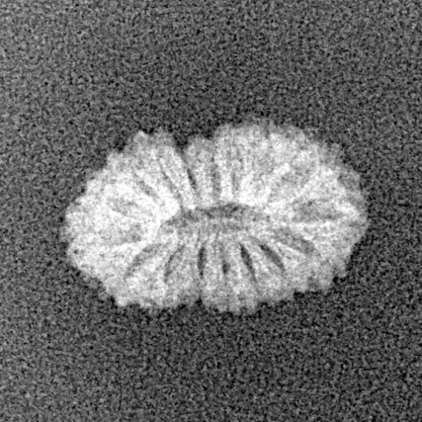 17 Mukhi Rudraksha 14.5mm 0.54gm - Xray