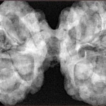 10 Mk Gaurishankar 42.7mm 10.98gm - Origin: Nepal - Xray