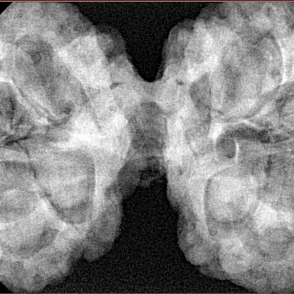10 Mk Gaurishankar 42.7mm 10.98gm - Origin: Nepal - Xray