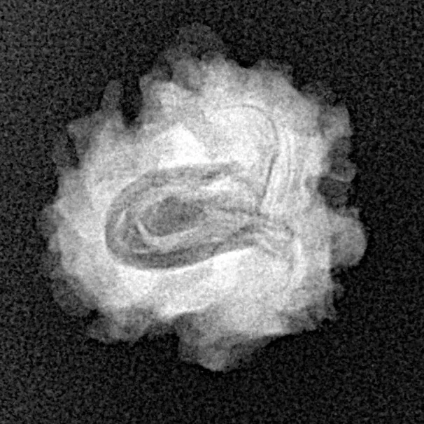 1 Mukhi Rudraksha 18.8mm 1.75gm - Xray