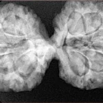 11 MK Gaurishankar 38mm 7.58gm - Xray