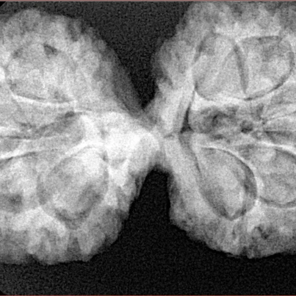 11 MK Gaurishankar 38mm 7.58gm - Xray