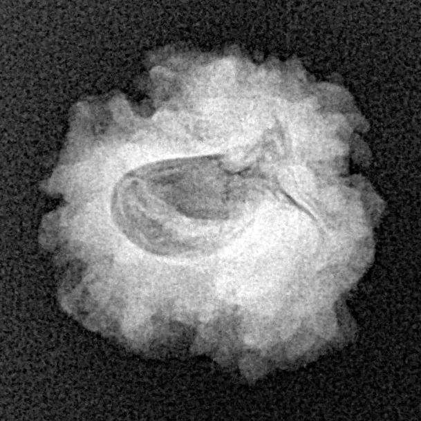 1 Mukhi Rudraksha 19.3mm 2.19gm - Xray