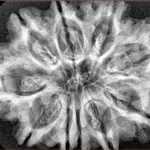 10 Mukhi Rudraksha 32.6mm 5.86gm - Xray