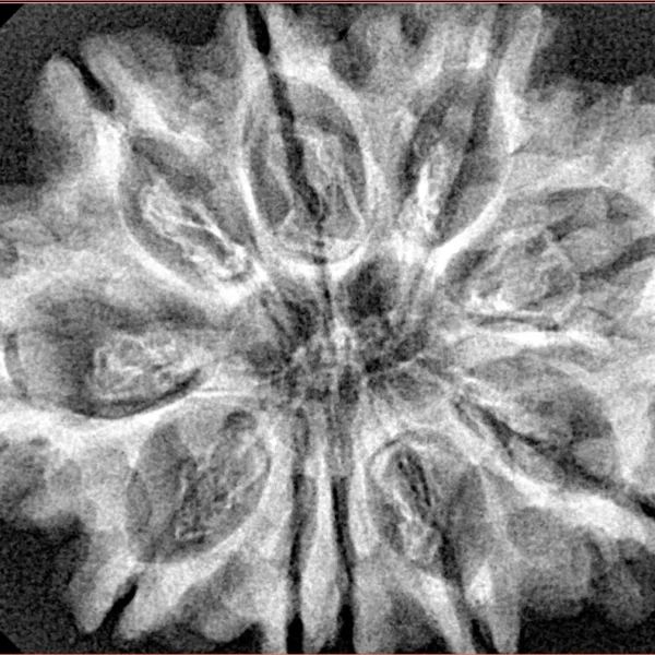 10 Mukhi Rudraksha 32.6mm 5.86gm - Xray