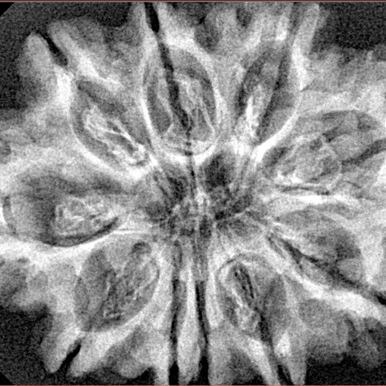 10 Mukhi Rudraksha 32.6mm 5.86gm - Xray