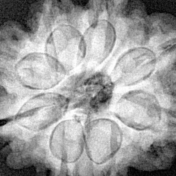 8 Mukhi Rudraksha 26.1mm 6gm - Xray