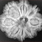 8 Mukhi Rudraksha 27.6mm 6.25gm - Xray