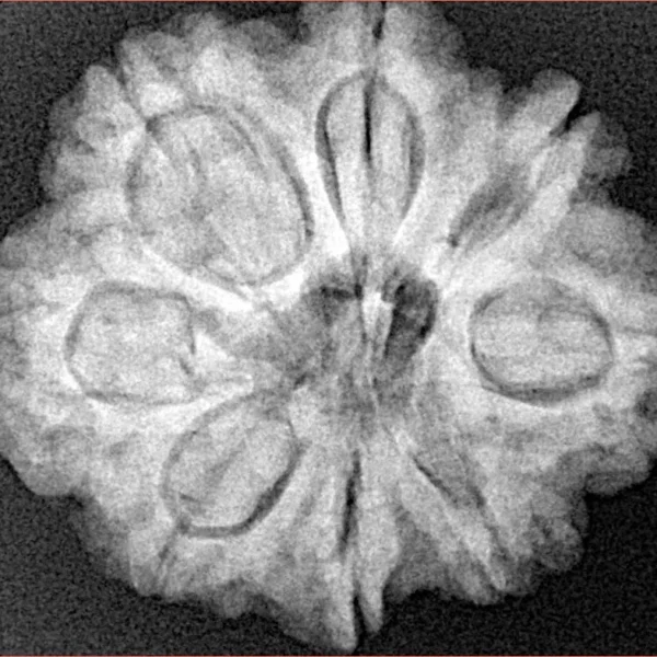8 Mukhi Rudraksha 27.6mm 6.25gm - Xray