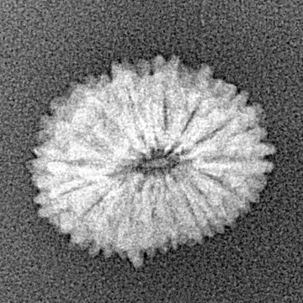 17 Mukhi Rudraksha 17.3mm 1.09gm - Xray