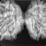 10 Mk Gaurishankar 39.6mm 8.3gm - Xray