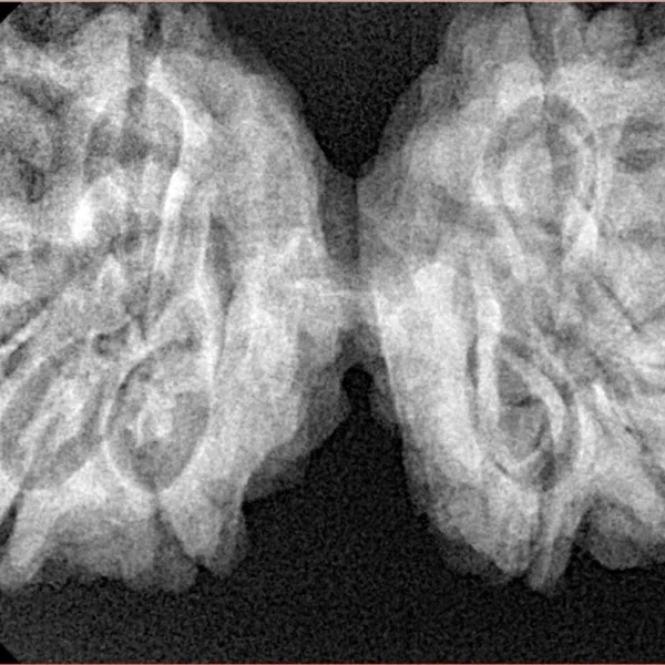 10 Mk Gaurishankar 39.6mm 8.3gm - Xray