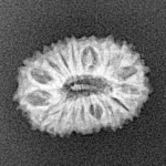 17 Mukhi Rudraksha 18mm 1.42gm - Xray