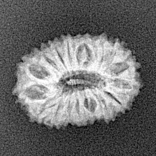 17 Mukhi Rudraksha 18mm 1.42gm - Xray