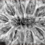 11 Mukhi Rudraksha 37.8mm 10.41gm - Xray