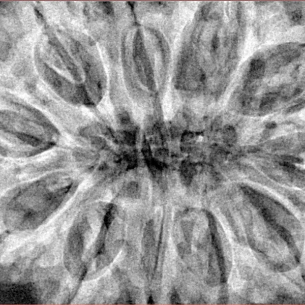 11 Mukhi Rudraksha 37.8mm 10.41gm - Xray