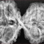 10 Mk Gaurishankar 40.7mm 9.38gm - Xray