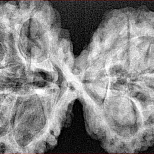 10 Mk Gaurishankar 40.7mm 9.38gm - Xray