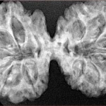 11 MK Gaurishankar 38.1mm 6.35gm - Xray