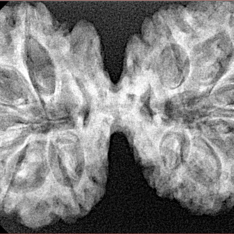 11 MK Gaurishankar 38.1mm 6.35gm - Xray