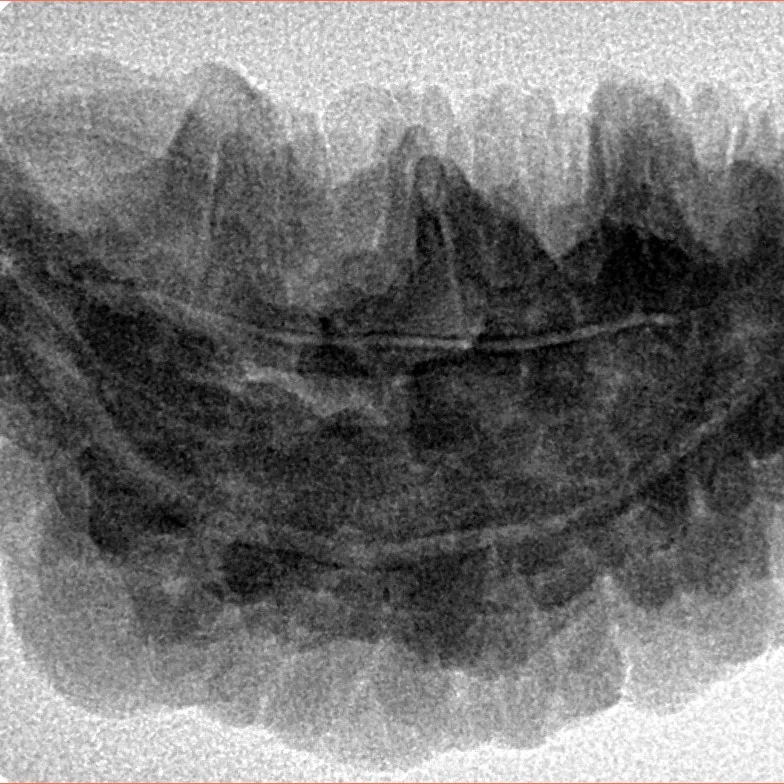 1 Mukhi Rudraksha 33.9mm 5.83gm - Inverse xray